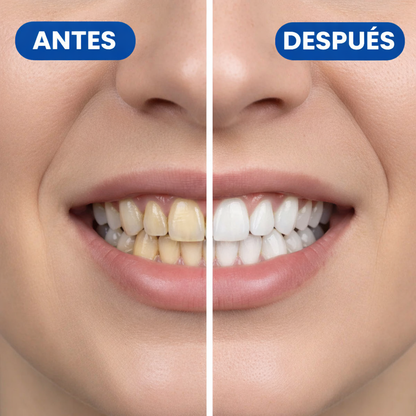 Tiras Blanqueadoras Calira+